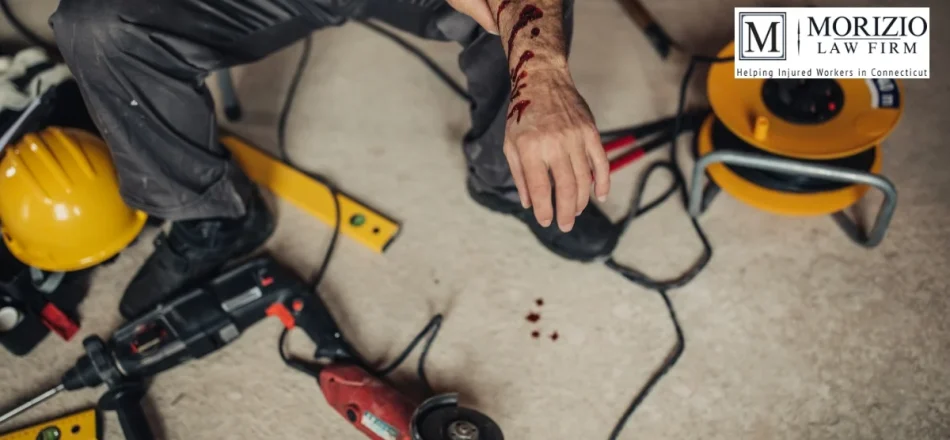 Can I choose my own doctor after a work injury? Image