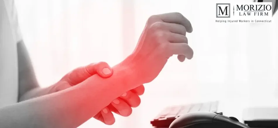Carpal Tunnel Syndrome and Workers’ Comp in Connecticut Image
