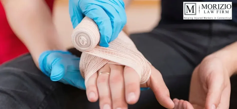 Proper Attire to Prevent Burn Injuries in Connecticut Workplaces Image